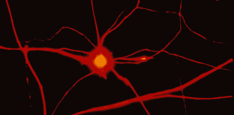 Motoneurones, image de microscopie à fluorescence