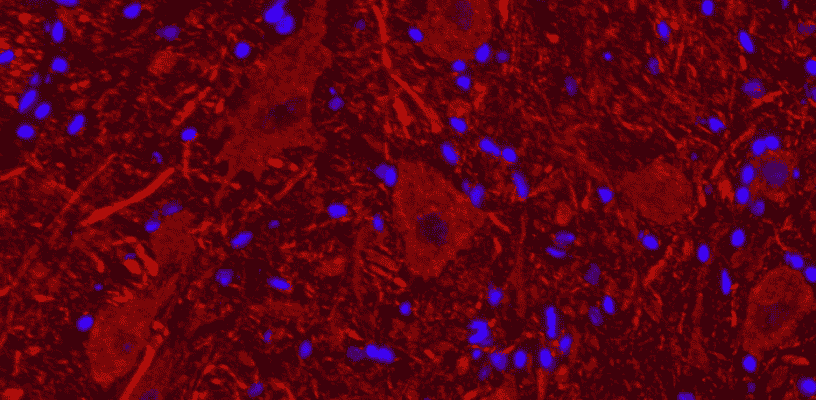 Motoneurones, image de microscopie à fluorescence